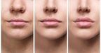 Velara Lip-Enhancing Serum For Instant Fuller Lips At Home