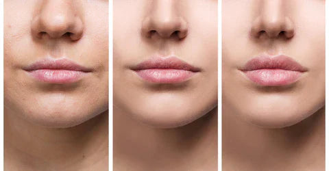 Velara Lip-Enhancing Serum For Instant Fuller Lips At Home