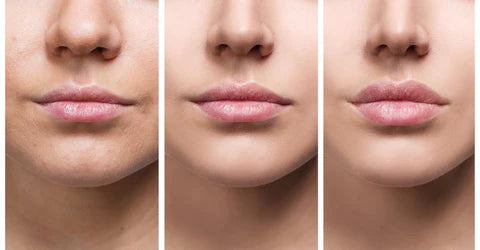 Dapatkan Bibir Lebih Penuh dengan Cepat Menggunakan Serum Pembesar Bibir LumaGlow
