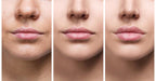 Dapatkan Bibir Lebih Penuh dengan Cepat Menggunakan Serum Pembesar Bibir LumaGlow