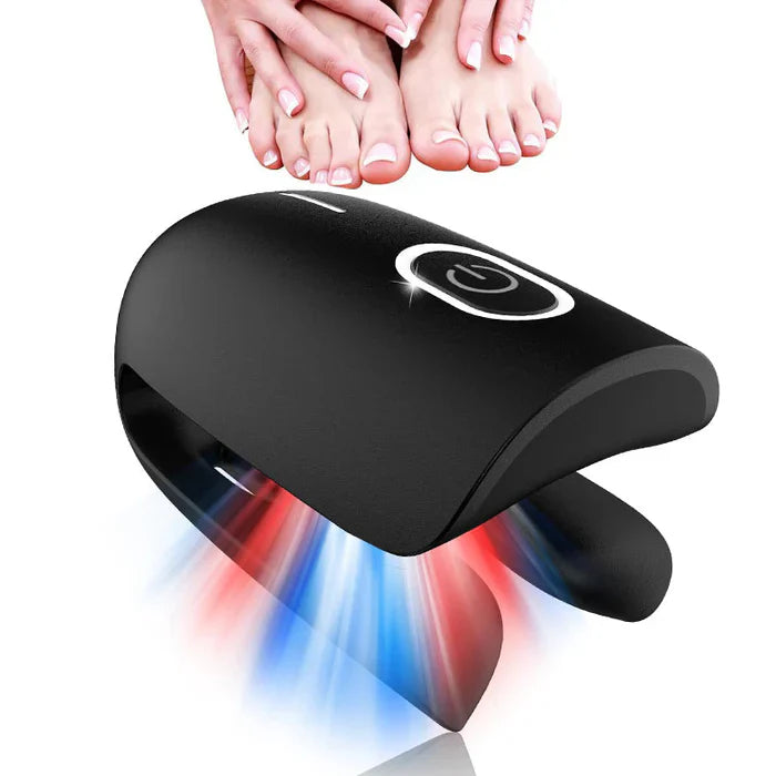 Dreiwellenlängen-Nagellaser für Fingernägel und Zehennägel System