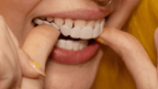 LumaGrin Quick Snap Veneers For Upper And Lower Teeth