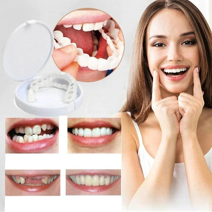 LumaGrin Quick Snap Veneers For Upper And Lower Teeth
