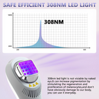 Lumière pour vitiligo et psoriasis à domicile avec lampe UVB 308 nm