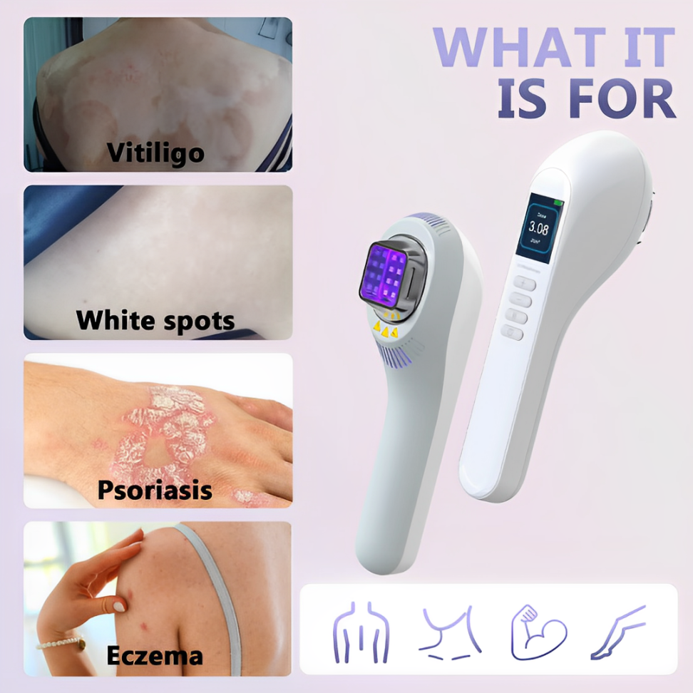Lumière pour vitiligo et psoriasis à domicile avec lampe UVB 308 nm