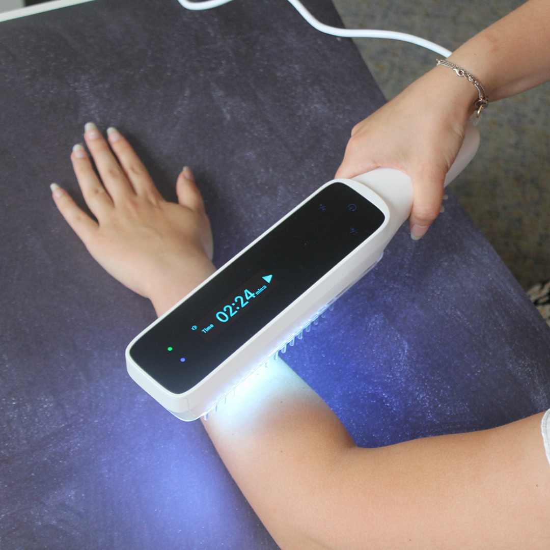 AureaBeam Handheld UVB Narrowband Phototherapy Lamp For Domestic Use