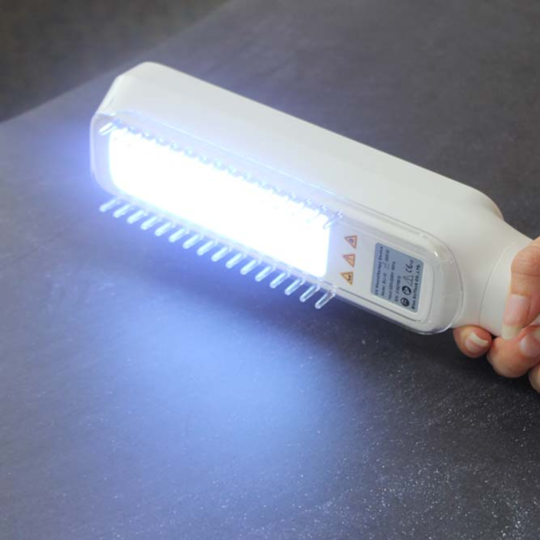 AureaBeam Handheld UVB Narrowband Phototherapy Lamp For Domestic Use