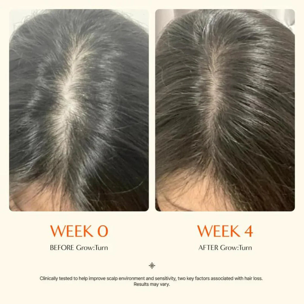 Scalp Growth Serum For Fuller Hair Less Shedding Thinning And Irritation