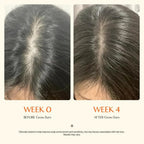 Scalp Growth Serum For Fuller Hair Less Shedding Thinning And Irritation