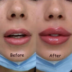 Velara Lip-Enhancing Serum For Instant Fuller Lips At Home