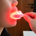 Home Red Light Unit For Gum Comfort And Gentle Tooth Healing
