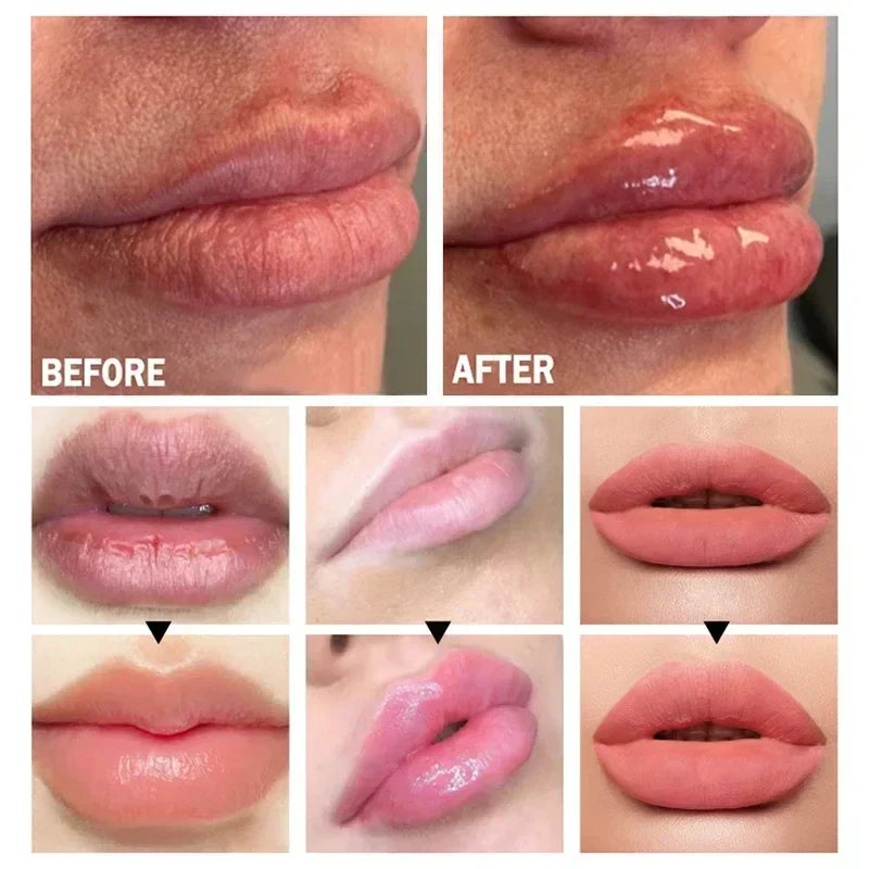 Velara Lip-Enhancing Serum For Instant Fuller Lips At Home