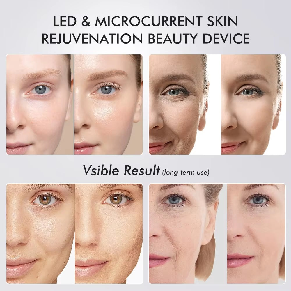 Six In One LED Skin Renewal Tool For Radiant Complexion