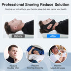 SomniSeal Chin Strap To Reduce Snoring At Night Time Comfort