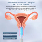 Varita de terapia de luz vibratoria para mujer con temporizador inteligente
