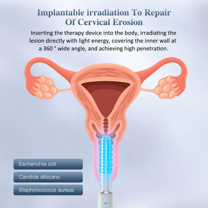 Varita de terapia de luz vibratoria para mujer con temporizador inteligente