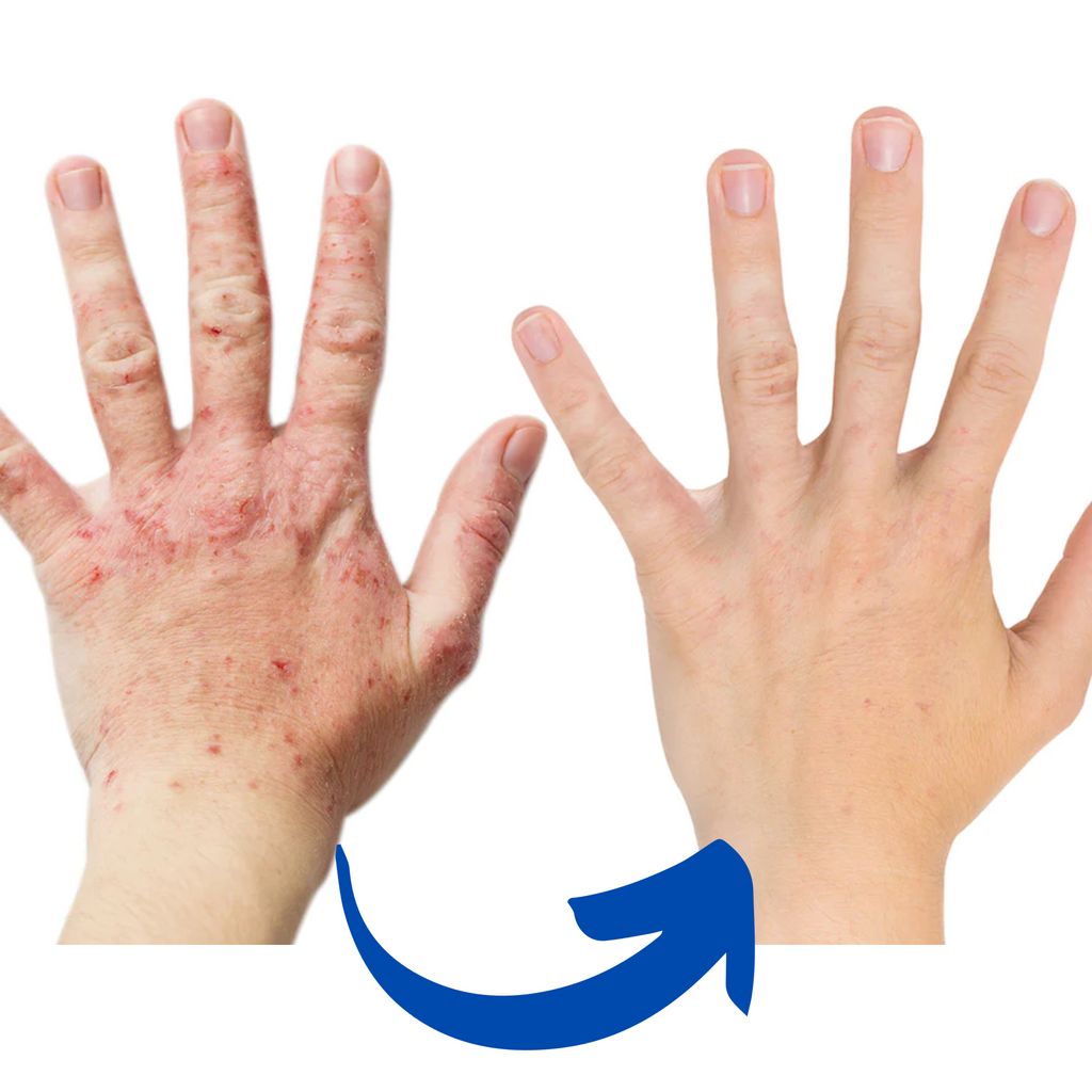 ArthroGlow Infrared Therapy Gloves For Arthritis Pain Relief