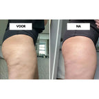Massaggio Vacuum CelluLift a Tessuto Profondo per una Pelle più Soda