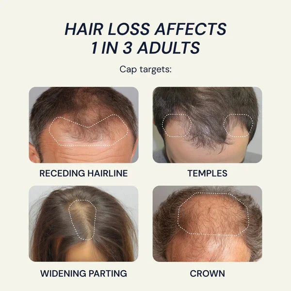 Biochance Cap For Hair Growth System Using Red Light