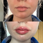 Velara Lip-Enhancing Serum For Instant Fuller Lips At Home