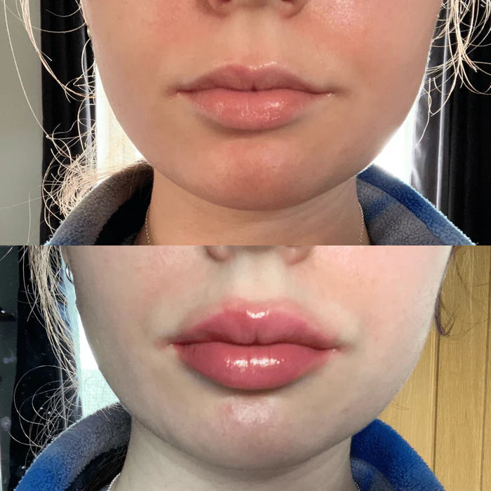 Dapatkan Bibir Lebih Penuh dengan Cepat Menggunakan Serum Pembesar Bibir LumaGlow
