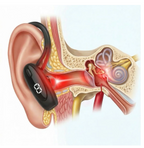 Tinnitus Relief Kit With Red Light Ear Device Sleep Headband And Sound Therapy App