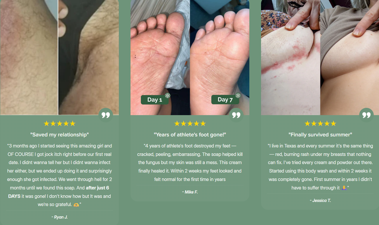 Mantar Cilt Bakımı için Antifungal Vücut Yıkama