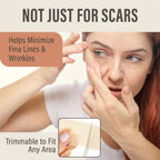 SilkScar Silicone Tape | Medical-Grade Scar Treatment for Flat, Soft Scars