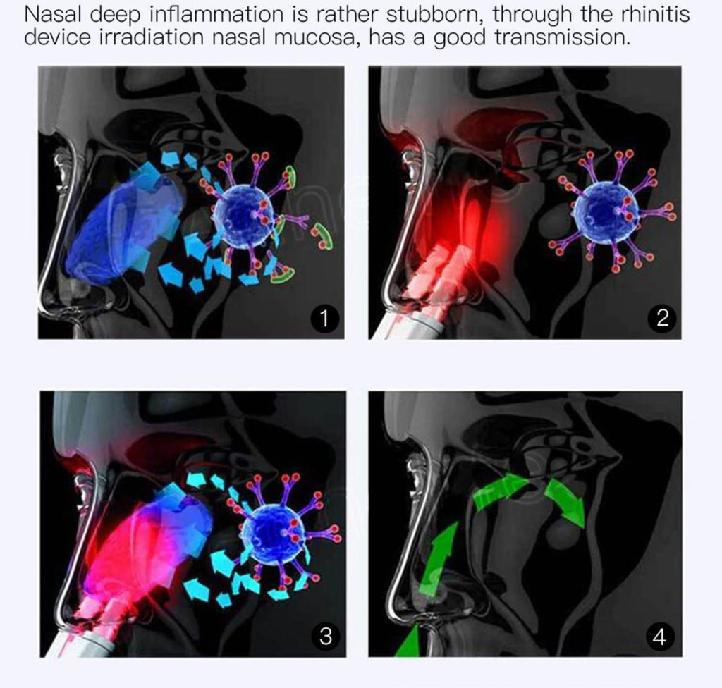 Infrared Therapy For Nasal Relief To Ease Breathing At Home