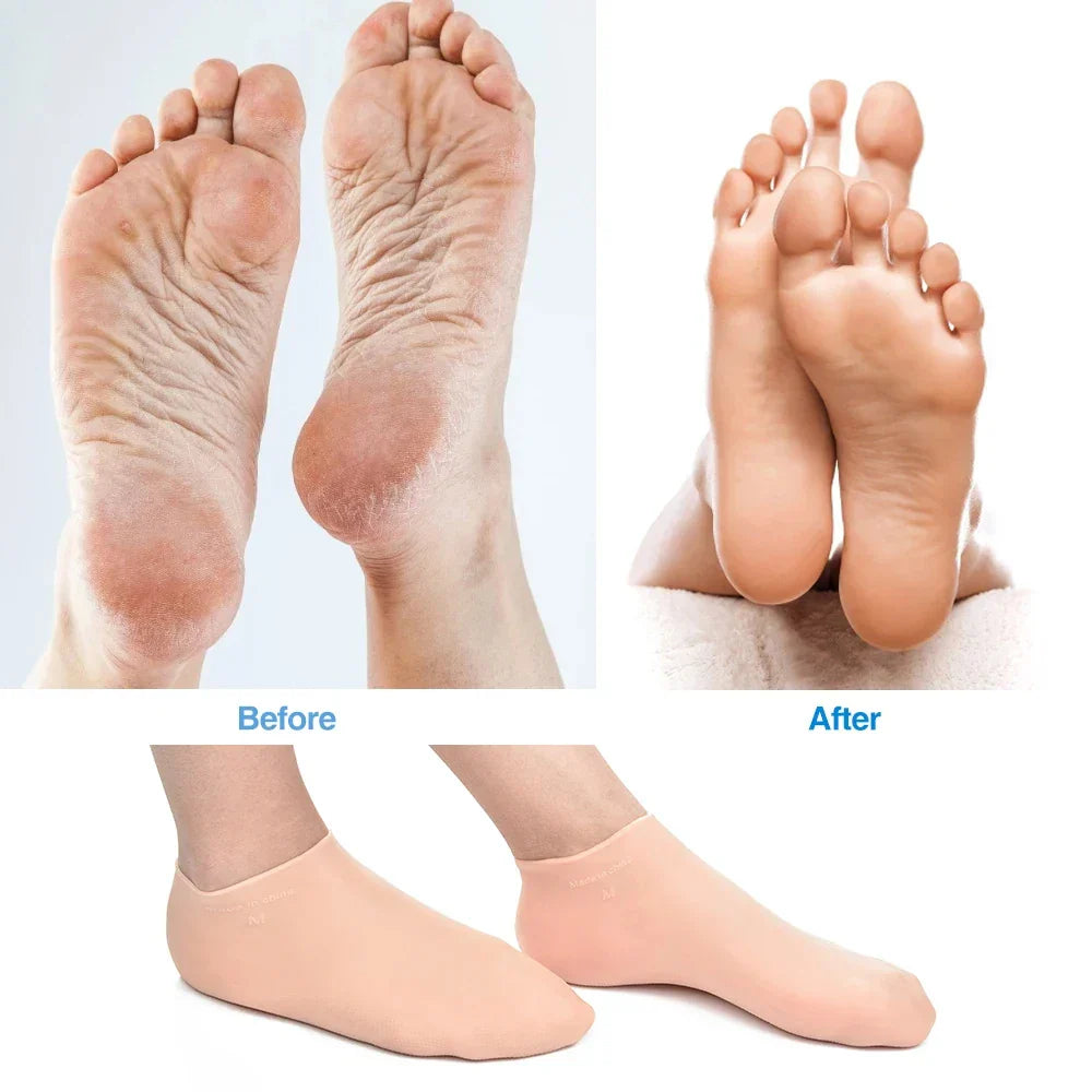 Silicone Wetsuit Beach Socks