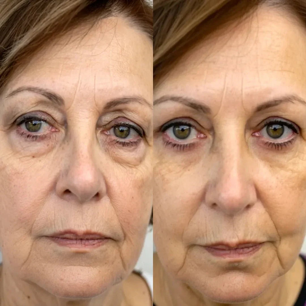 RadianceLift Quick Under-Eye Renewal Kit For Ten-Minute Refresh