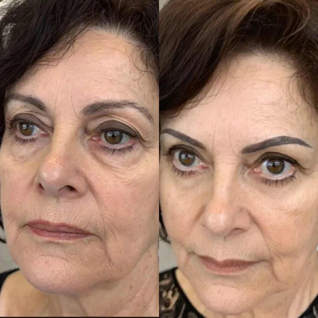 RadianceLift Quick Under-Eye Renewal Kit For Ten-Minute Refresh