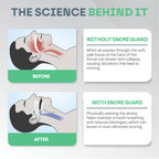 SomniGuard Snore-Preventing Mouth Guard For Restful Sleep