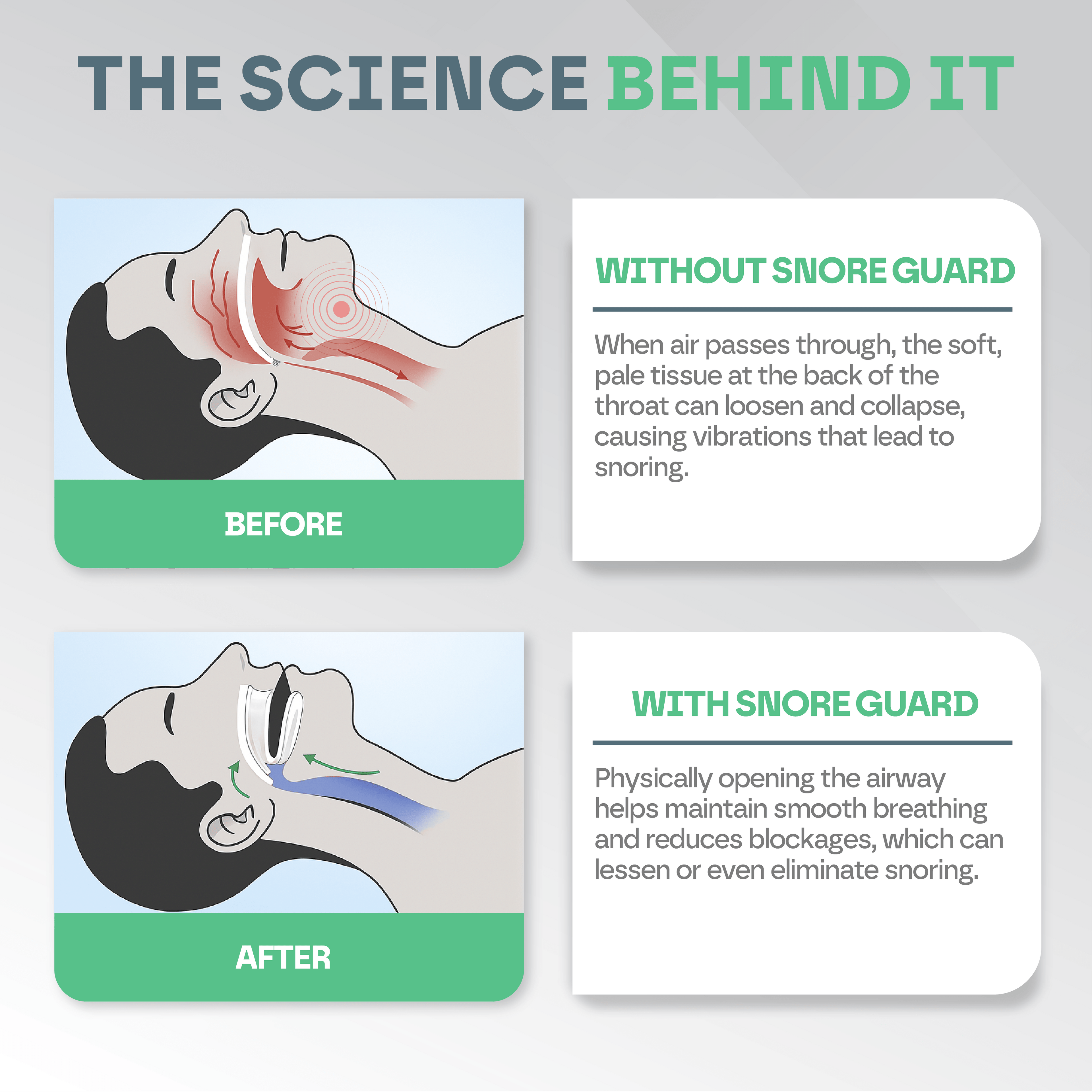SomniGuard Snore-Preventing Mouth Guard For Restful Sleep
