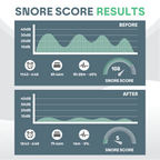 SomniGuard Snore-Preventing Mouth Guard For Restful Sleep