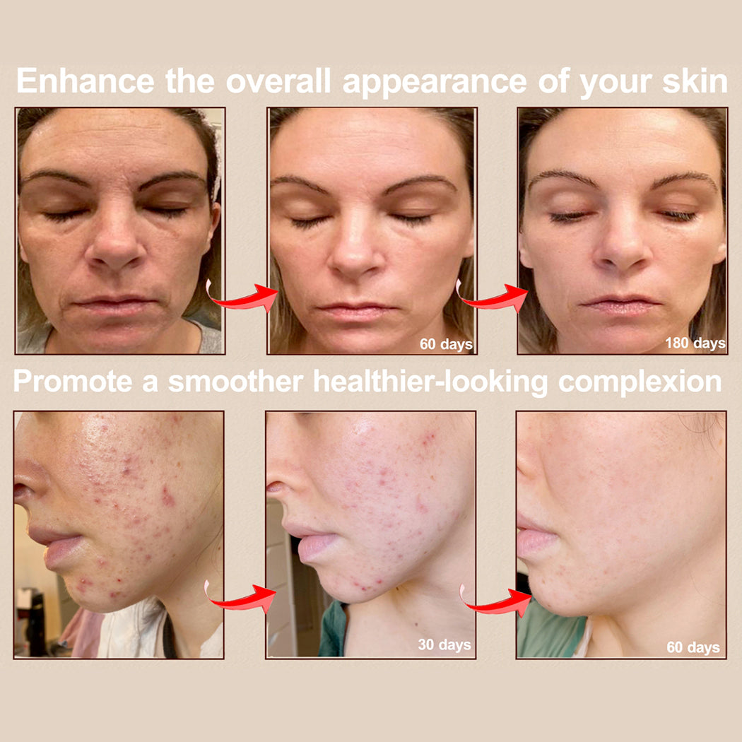 LuminaFlex LED Therapy Mask | Face & Neck Professional Light Treatment at Home