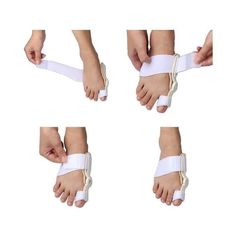 OrthoEase Non Surgical Toe Realignment Support Splint