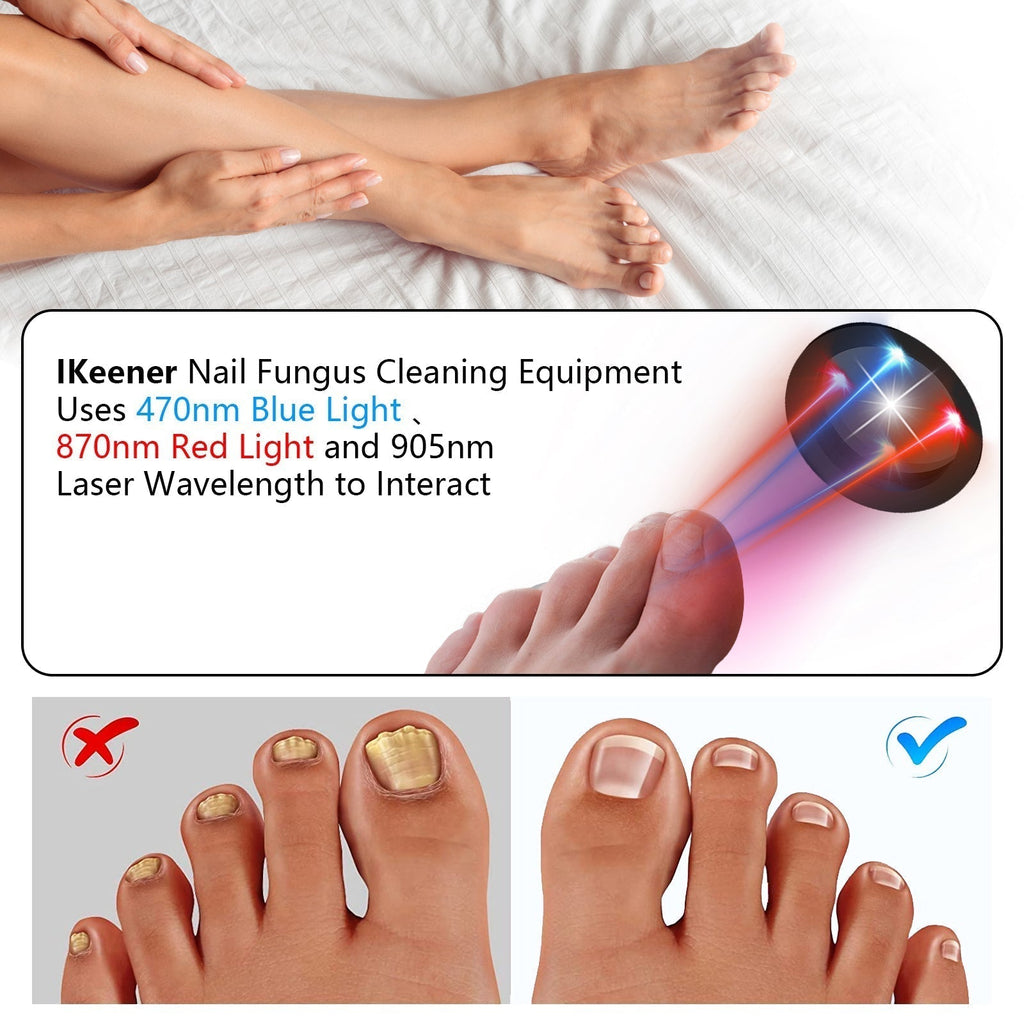 ApexNova Laser Nail System For Easy Home Use And DIY Care