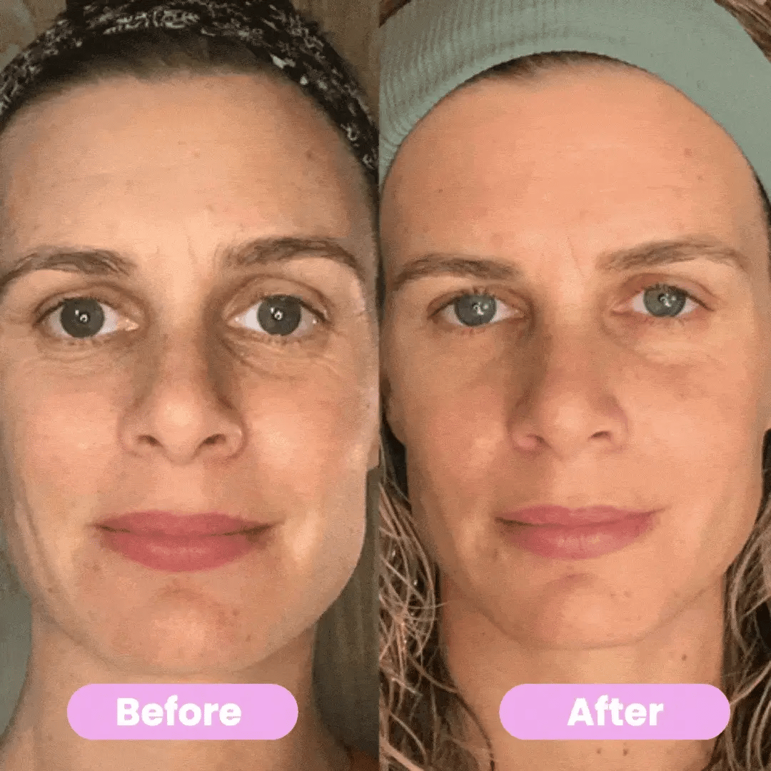 SculptGlow 7-in-1 LED Face Sculptor | Rejuvenate, Firm & Brighten Your Skin at Hom