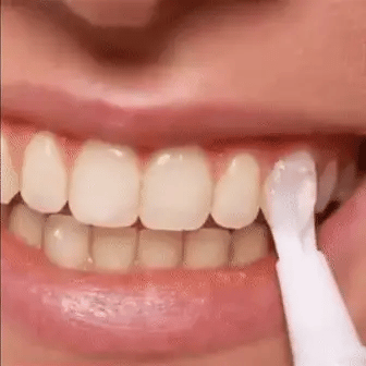 Swift Pro Edition illumina il tuo sorriso con uno sbiancamento dentale rapido