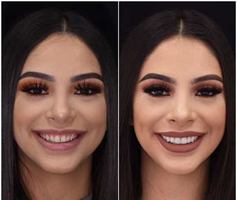LumaGrin Quick Snap Veneers For Upper And Lower Teeth