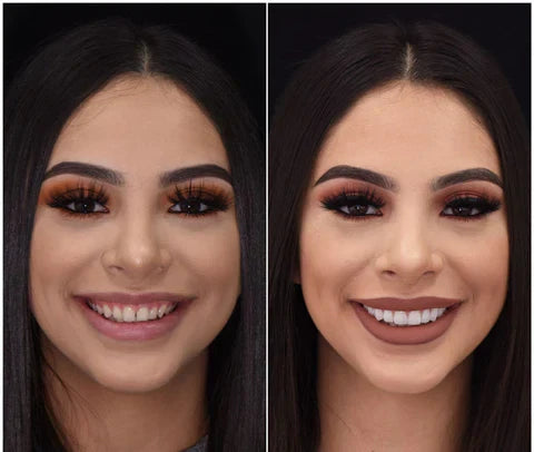 Nakładki Snap-On Veneers od NovaBright – szybki, naturalny uśmiech na górne i dolne zęby