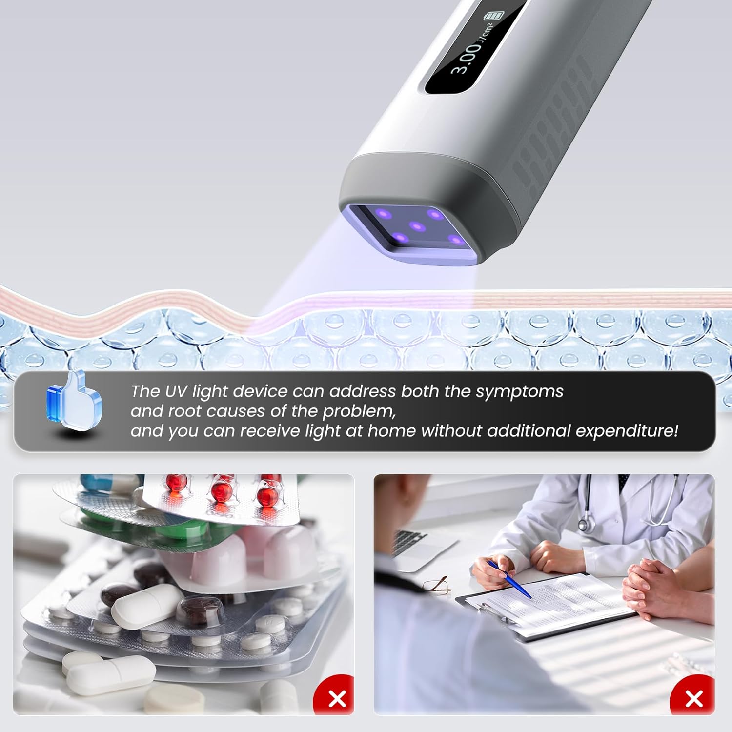 Dispositivo de Fototerapia UVB Portátil 308nm 2026 – Tratamiento en Casa para Psoriasis, Eccema, Vitiligo y Más
