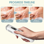 2026 Draagbaar 308nm UVB Licht Fototherapieapparaat – Thuisbehandeling voor Psoriasis, Eczeem, Vitiligo en Meer