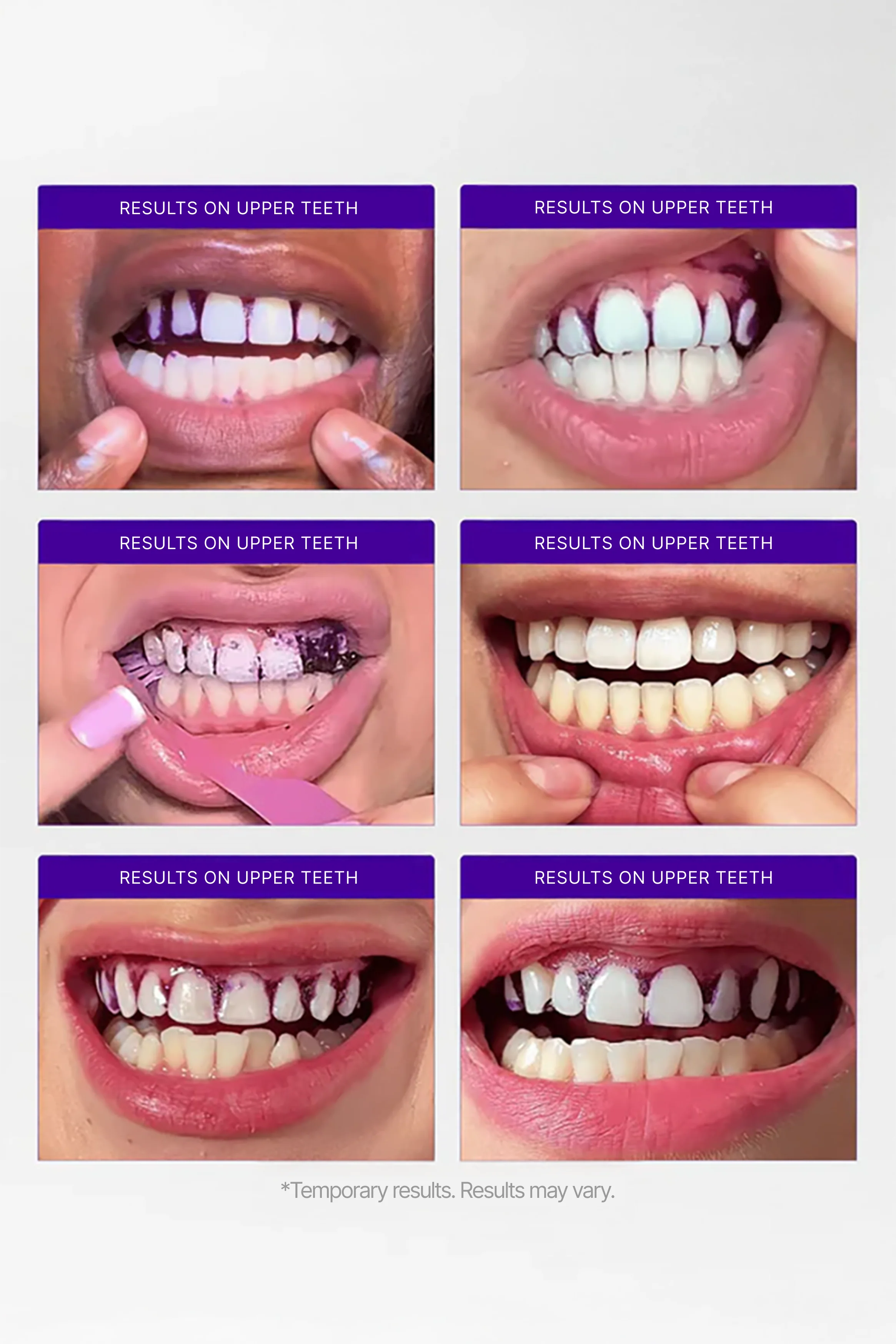 V34 Teeth Whitening Strips