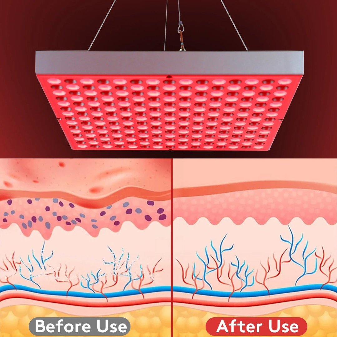 SolaraLift Rotlichtlampe zur Förderung von erholsamem Schlaf, Schmerzlinderung und Hautgesundheit