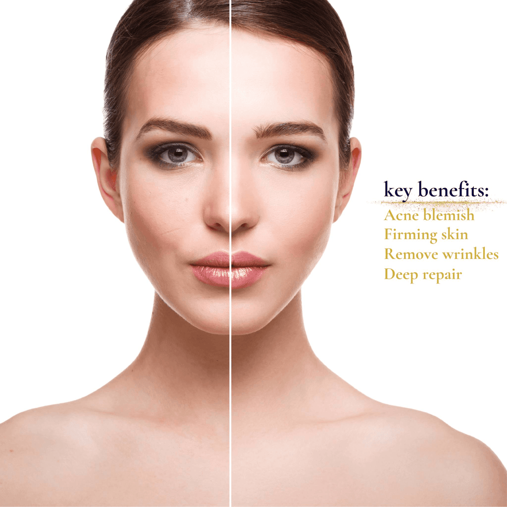 Aging Skin Photon Therapy Mask Brightens, Tightens, And Firms