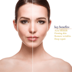 Aging Skin Photon Therapy Mask Brightens, Tightens, And Firms