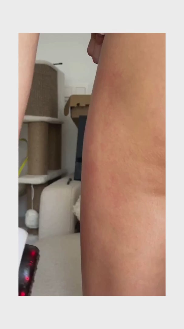 Dispositivo 4-in-1 per il rimodellamento e la levigatura del corpo per uso domestico