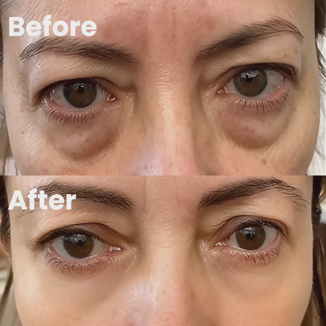 RadianceLift Quick Under-Eye Renewal Kit For Ten-Minute Refresh